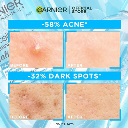 Garnier Anti Acne 3-in-1 Cleanser